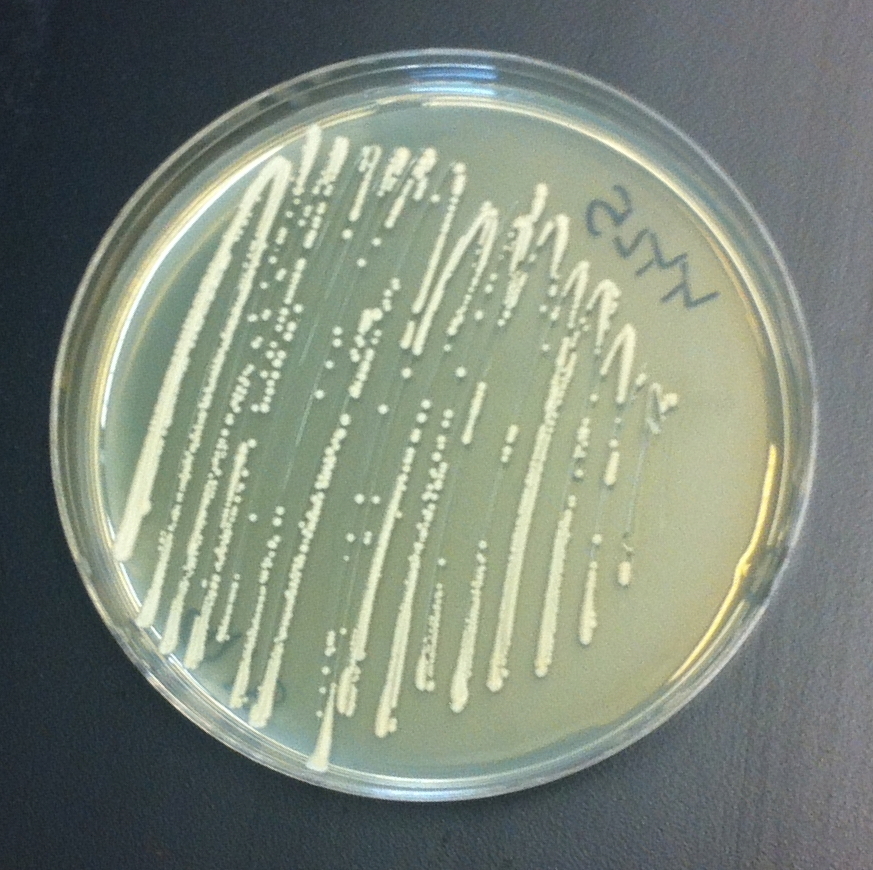 lab plate shows specimen of yeast